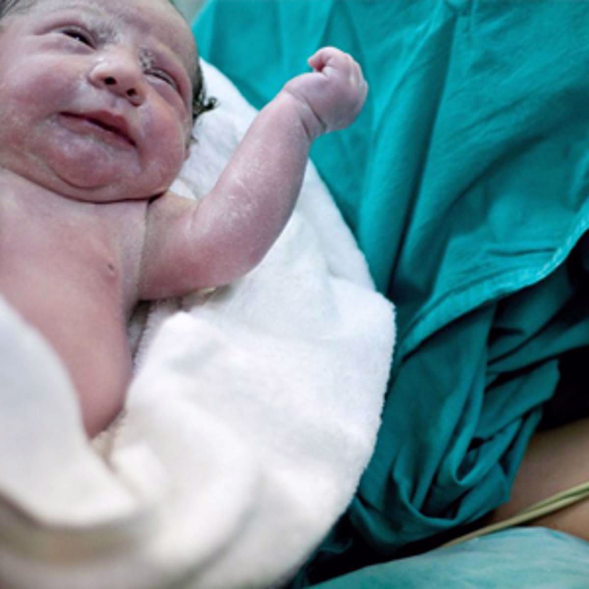 5 Things You Need to Know About C-Sections