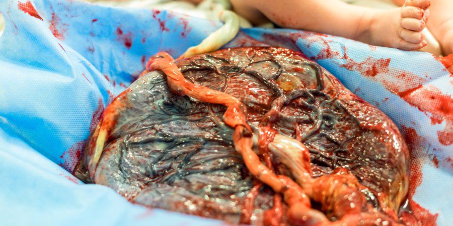 placenta after birth