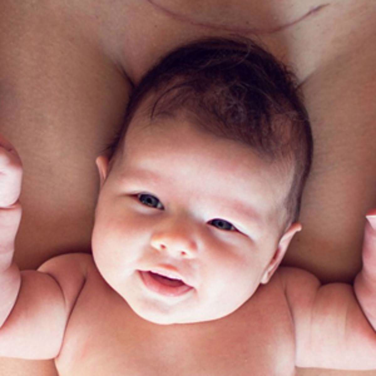 5 Things You Need to Know About C-Sections