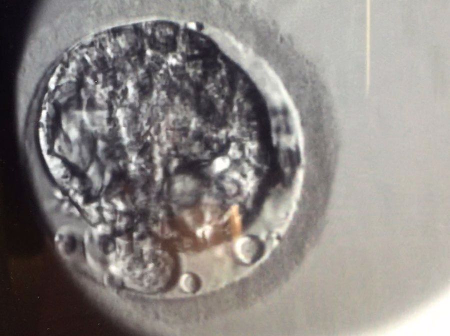 embryo during surrogacy implantation